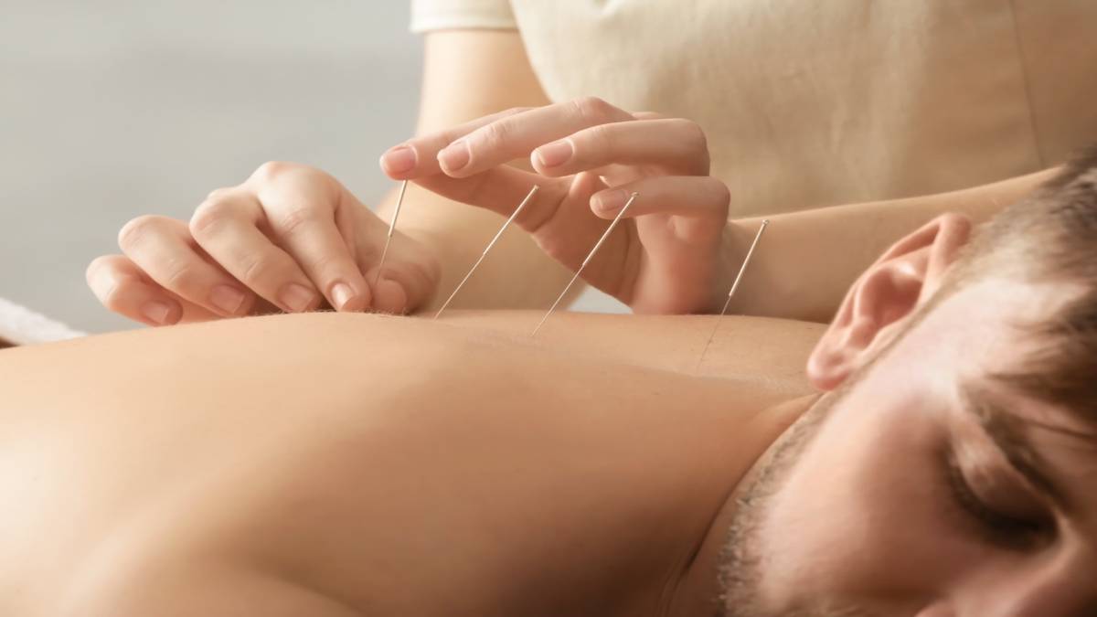 لیست بهترین مراکز طب سوزنی در منظریه + هزینه طب سوزنی