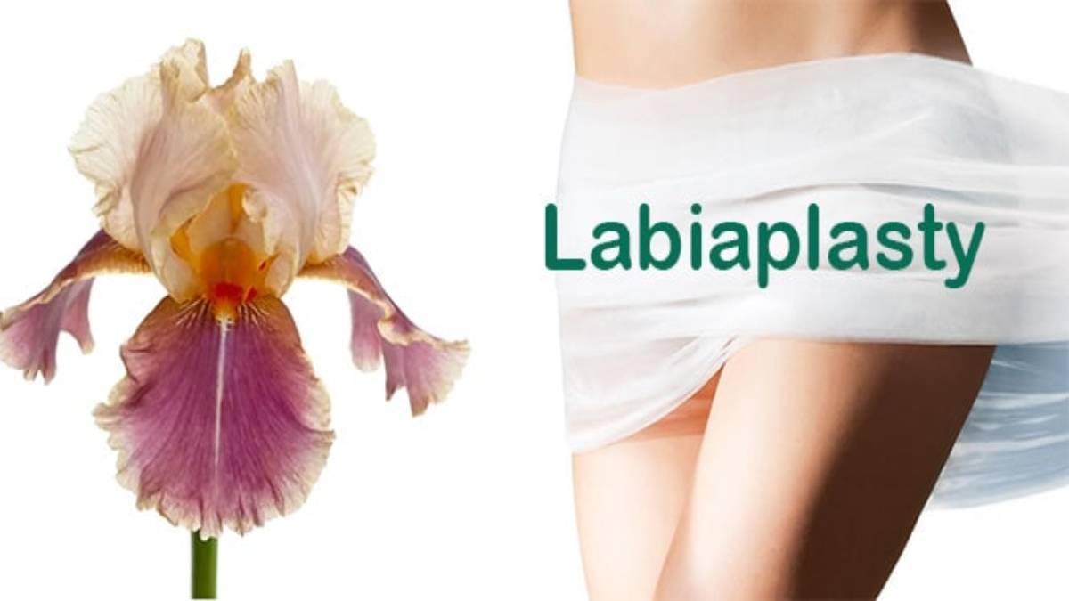 لیست بهترین مراکز لابیاپلاستی در منظریه + هزینه لابیاپلاستی