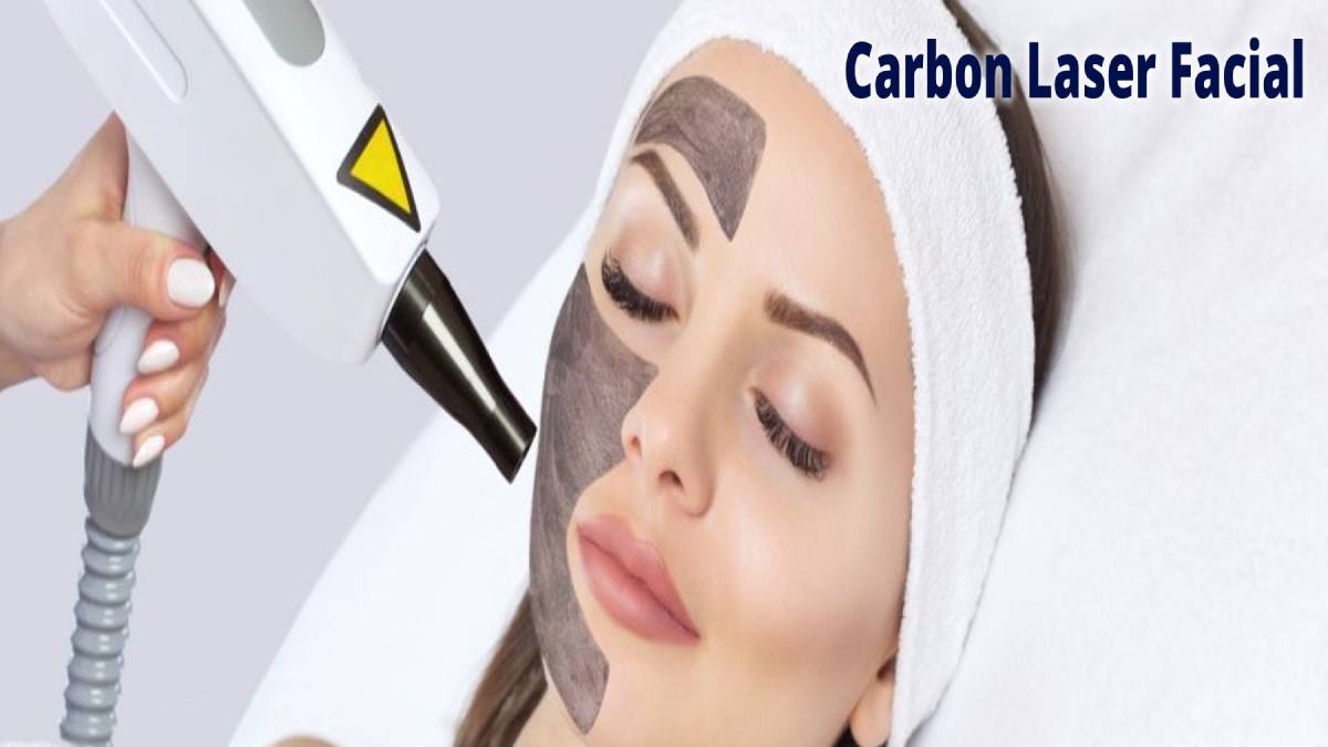 لیست بهترین مراکز پیلینگ کربن در اقدسیه + هزینه پیلینگ کربن