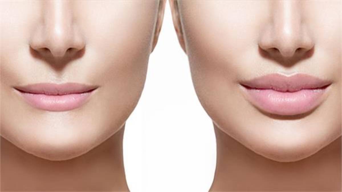 لیست بهترین مراکز لیفت سانترال لب در اقدسیه + هزینه لیفت سانترال لب