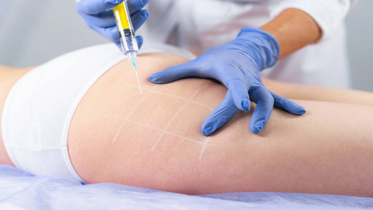 لیست بهترین مراکز تزریق چربی در اقدسیه + هزینه تزریق چربی