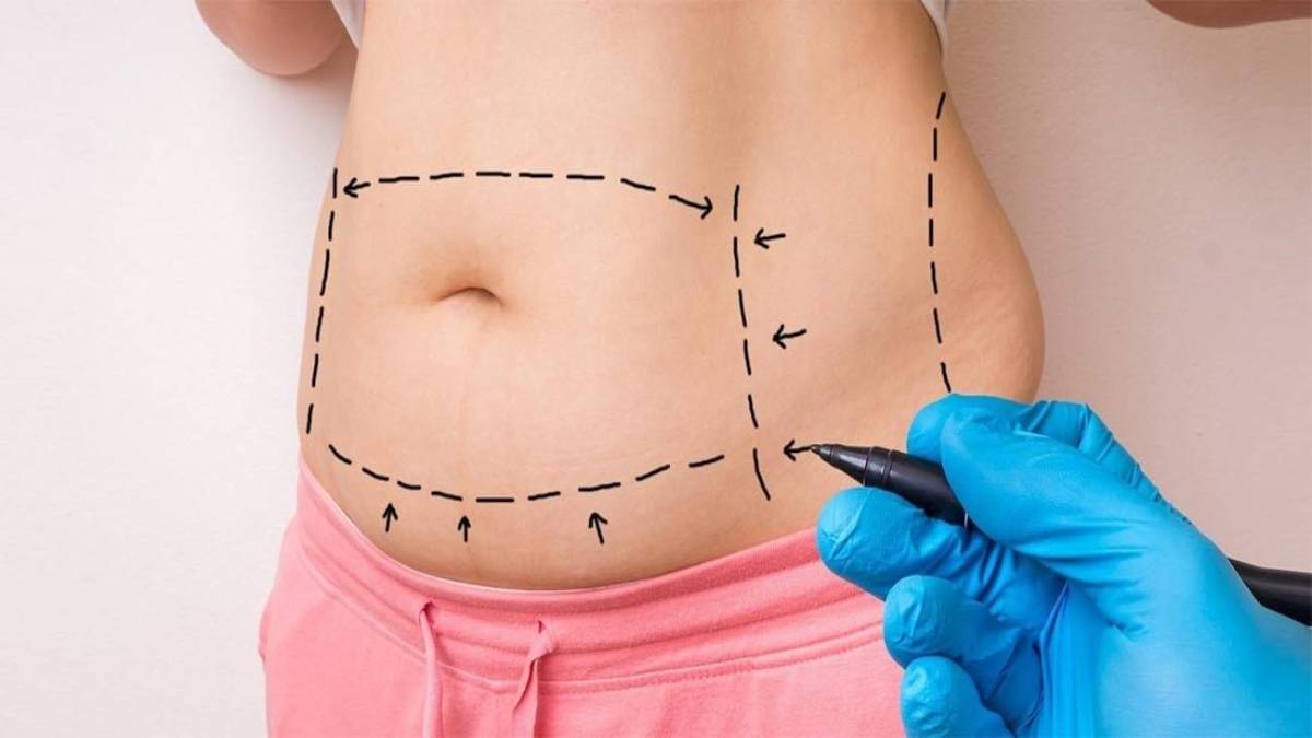 لیست بهترین مراکز لیپوماتیک در اقدسیه + هزینه لیپوماتیک