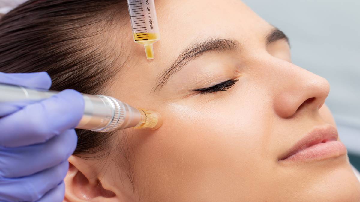لیست بهترین مراکز مزونیدلینگ در سعادت آباد + هزینه مزونیدلینگ