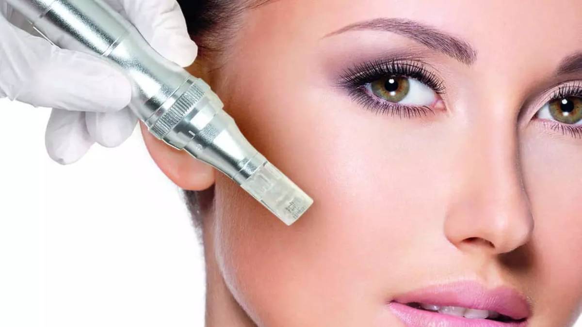 لیست بهترین مراکز مزونیدلینگ در اقدسیه + هزینه مزونیدلینگ