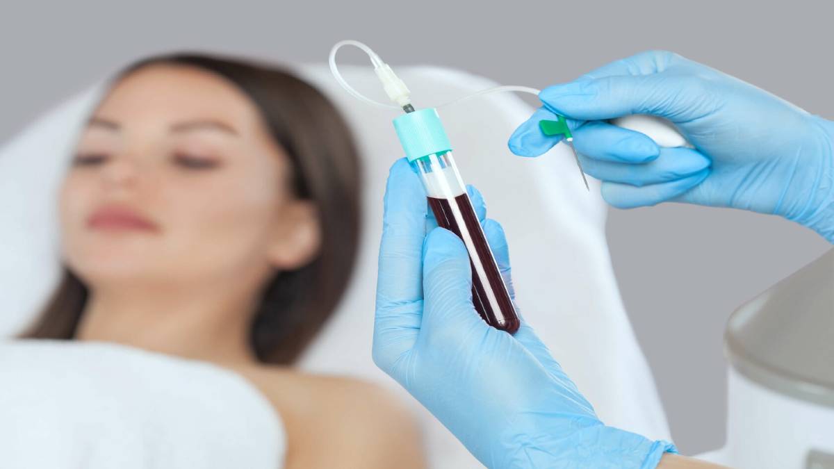 لیست بهترین مراکز تزریق پی آر پی در اقدسیه + هزینه تزریق پی آر پی
