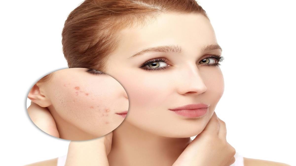 لیست بهترین مراکز سابسیژن در اقدسیه + هزینه سابسیژن