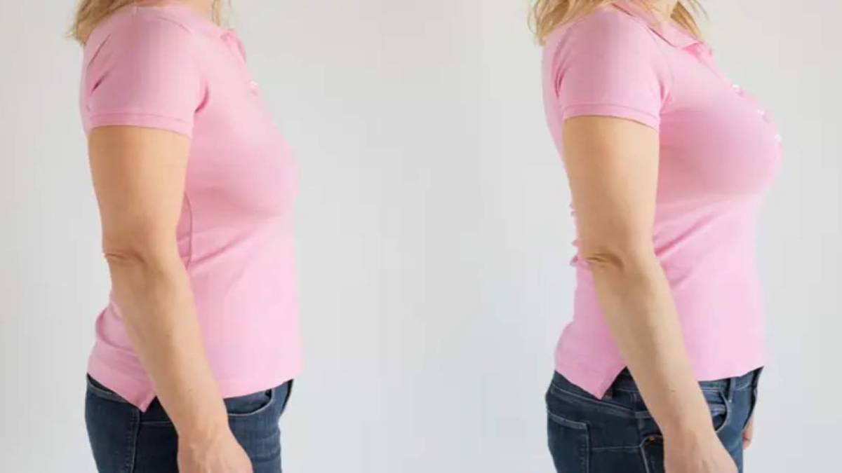 لیست بهترین مراکز لیفت سینه در اقدسیه + هزینه لیفت سینه