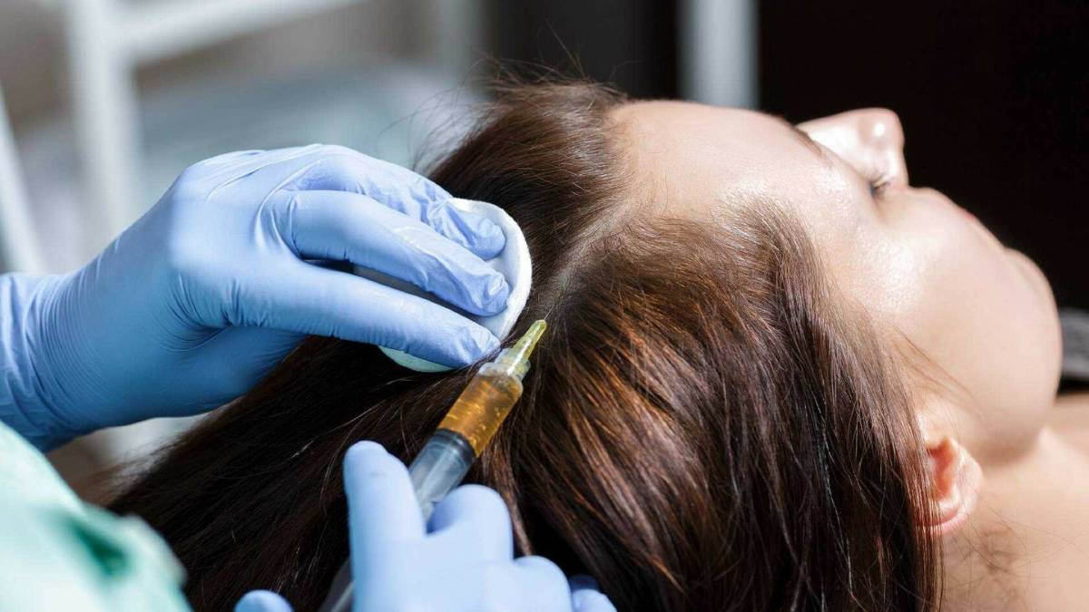 لیست بهترین مراکز مزوتراپی مو در اقدسیه + هزینه مزوتراپی مو