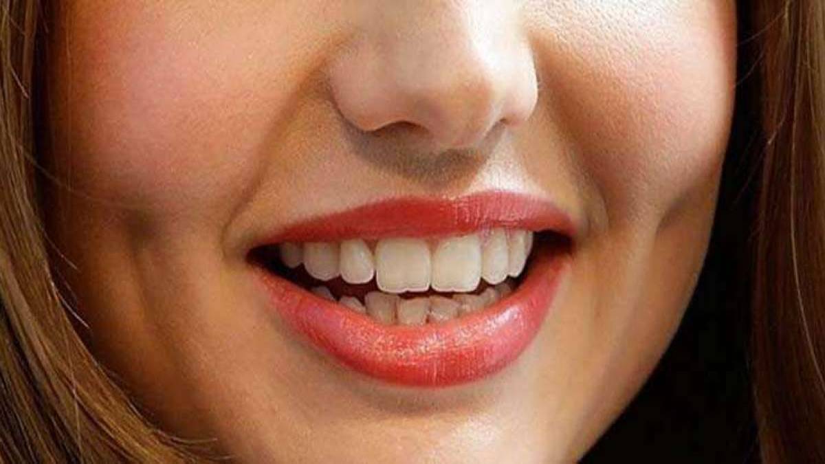 لیست بهترین مراکز کاشت چال گونه در اقدسیه + هزینه کاشت چال گونه