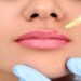 لیست بهترین مراکز تزریق ژل در سعادت آباد + هزینه تزریق ژل