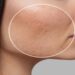 لیست بهترین مراکز سابسیژن در سعادت آباد + هزینه سابسیژن