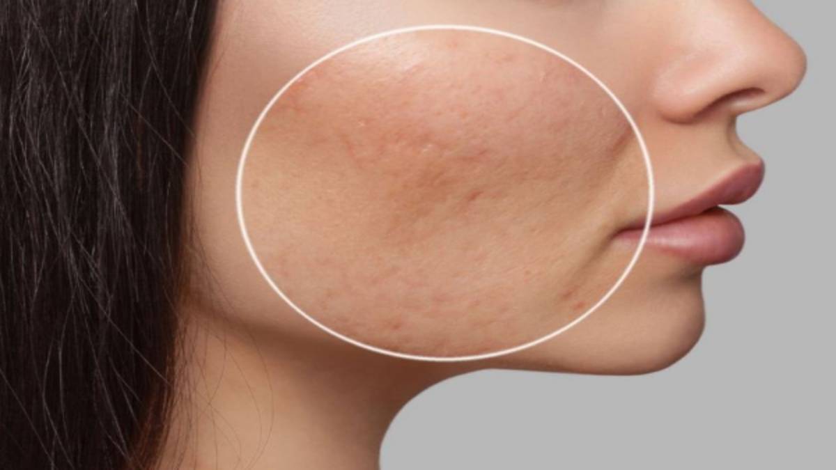 لیست بهترین مراکز سابسیژن در سعادت آباد + هزینه سابسیژن