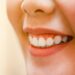 لیست بهترین مراکز درمان لبخند لثه ای در سعادت آباد + هزینه درمان لبخند لثه ای
