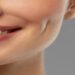 لیست بهترین مراکز کاشت چال گونه در سعادت آباد + هزینه کاشت چال گونه