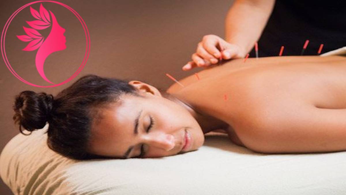 لیست بهترین مراکز طب سوزنی در پاسداران + هزینه طب سوزنی