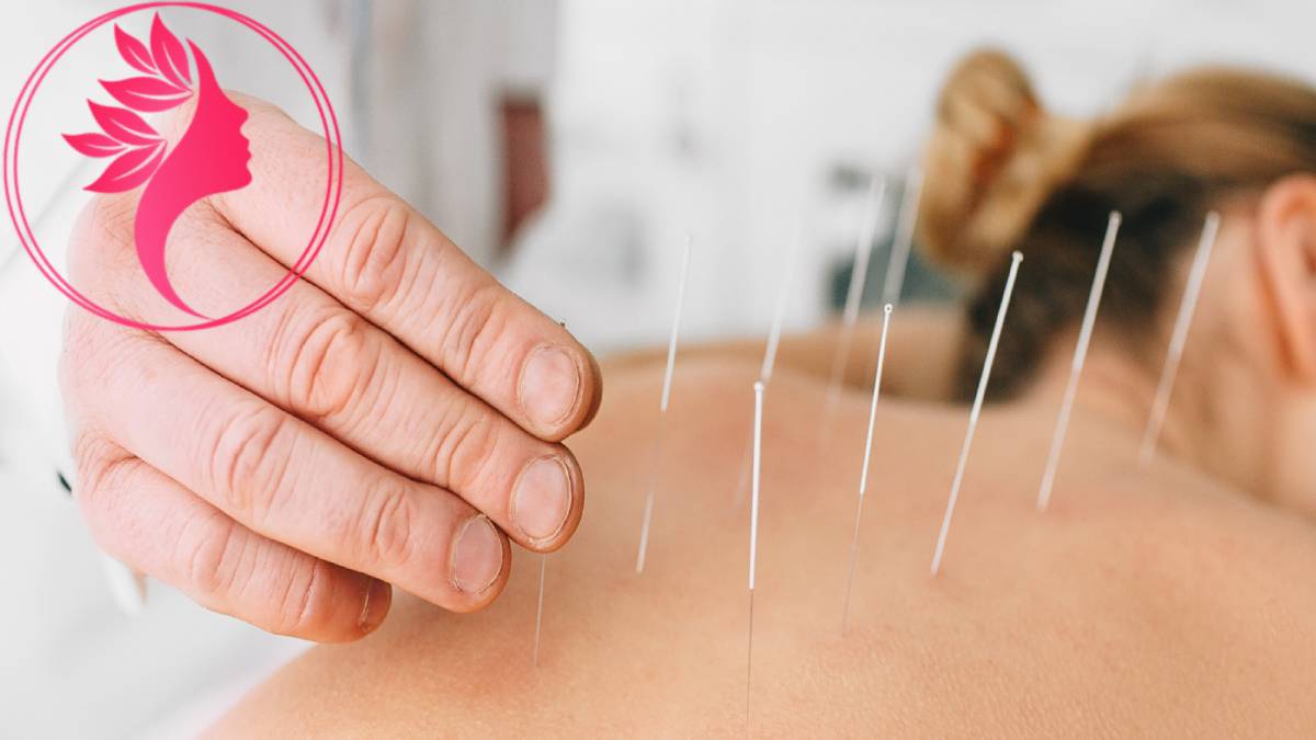 لیست بهترین مراکز طب سوزنی در اختیاریه + هزینه طب سوزنی