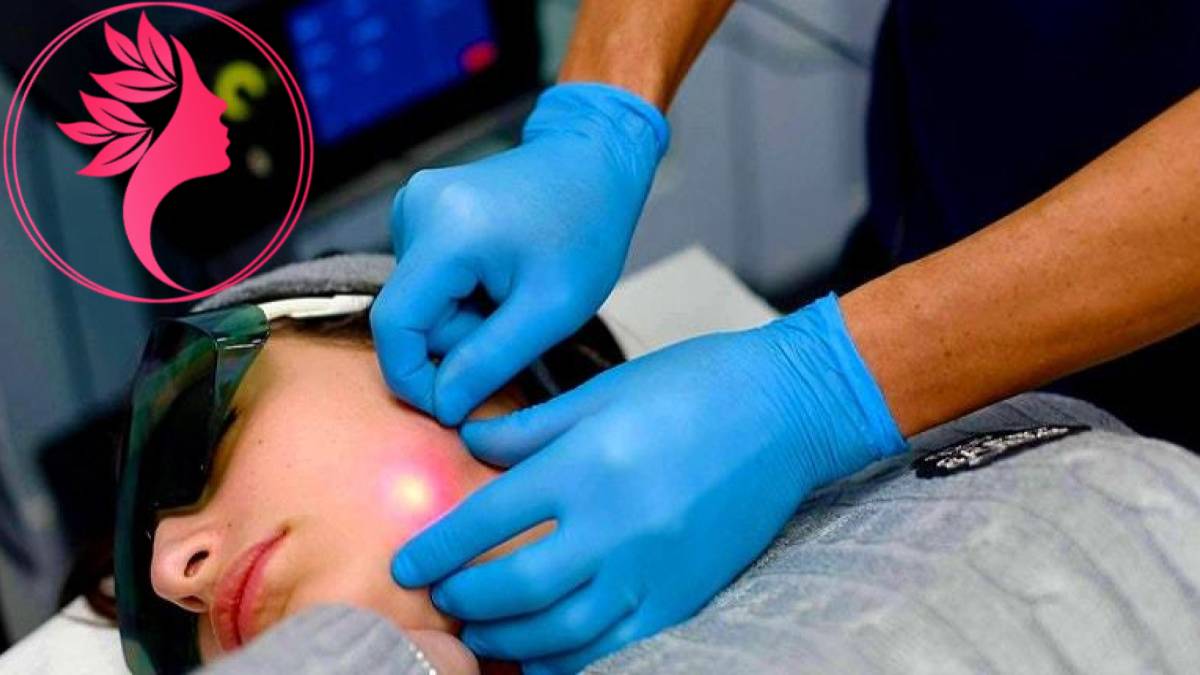 لیست بهترین مراکز اندولیفت در اختیاریه + هزینه اندولیفت