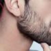 لیست بهترین مراکز کاشت ریش در شهرک غرب + هزینه کاشت ریش