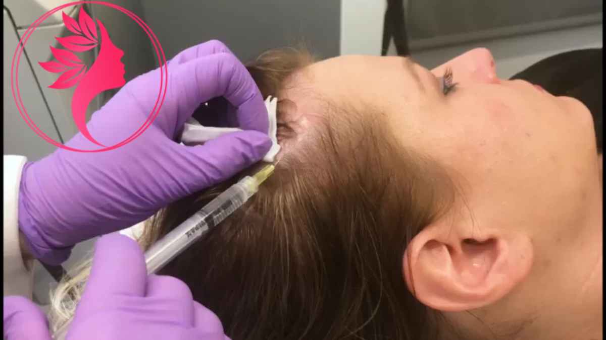 لیست بهترین مراکز مزوتراپی مو در شهرک غرب + هزینه مزوتراپی مو