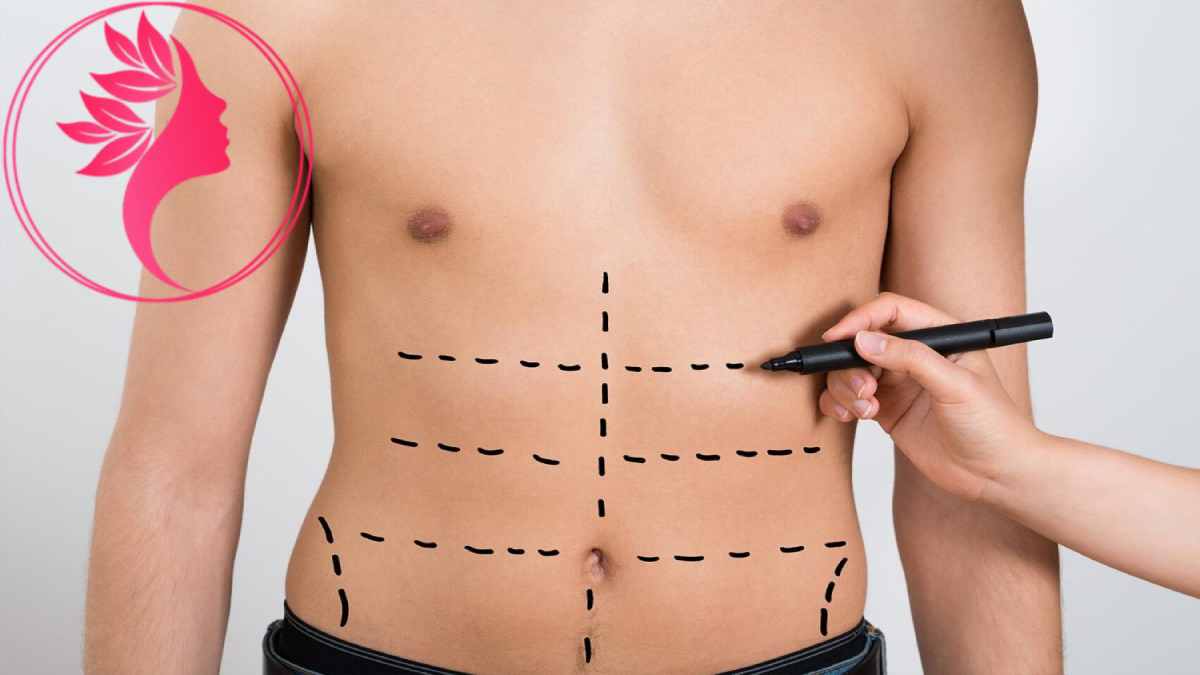 لیست بهترین مراکز پیکرتراشی در شهرک غرب + هزینه پیکرتراشی