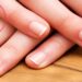 لیست بهترین مراکز جراحی ناخن در شهرک غرب + هزینه جراحی ناخن