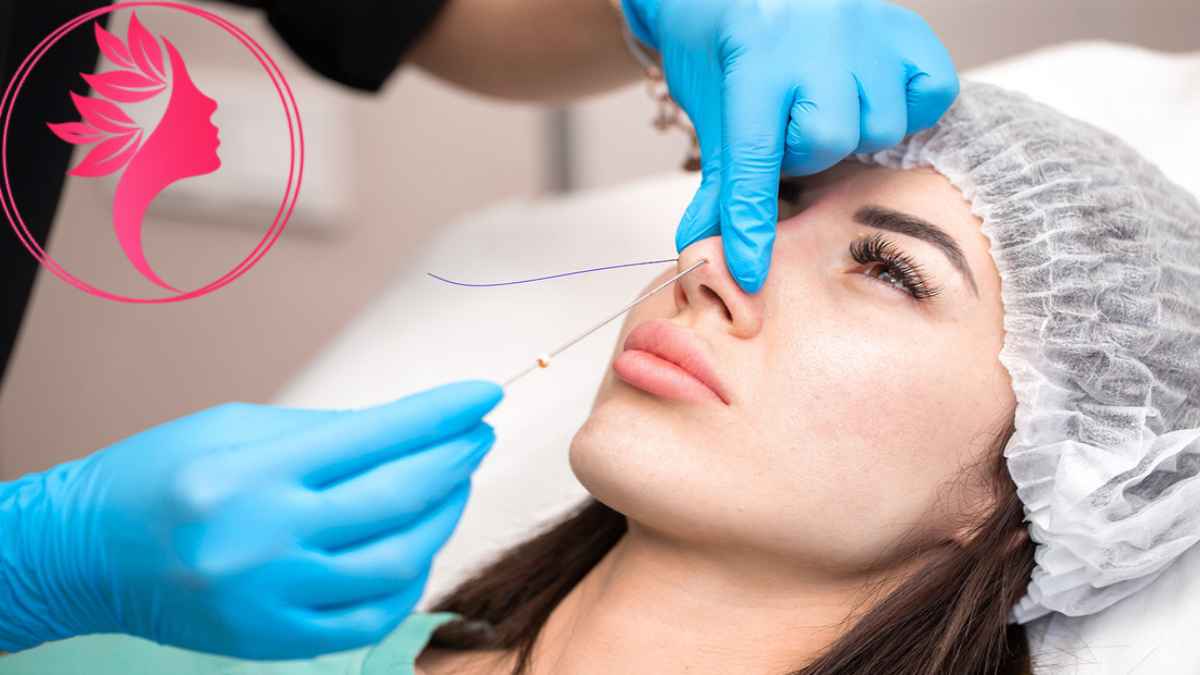 لیست بهترین مراکز لیفت بینی با نخ در شهرک غرب + هزینه لیفت بینی با نخ