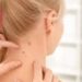 لیست مراکز ریمو ضایعات پوستی در شهرک غرب + هزینه ریمو ضایعات پوستی