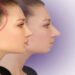 لیست بهترین مراکز جراحی چانه در شهرک غرب + هزینه جراحی چانه