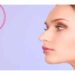 لیست بهترین مراکز تزریق آنزیم بینی در شهرک غرب + هزینه تزریق آنزیم بینی