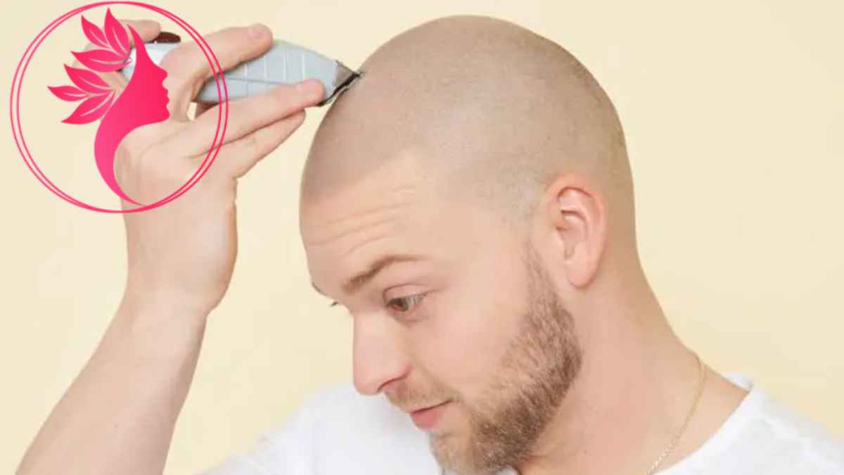 لیست بهترین مراکز میکرو اسکالپ در شهرک غرب + هزینه میکرو اسکالپ