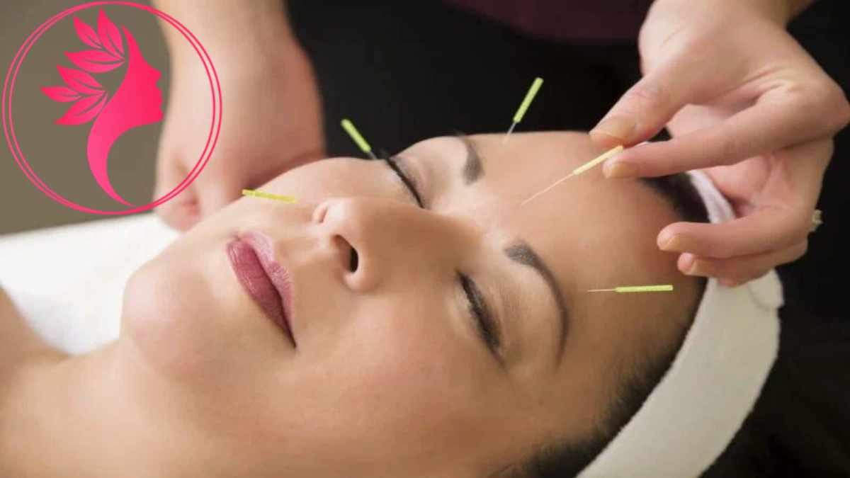 لیست بهترین مراکز طب سوزنی در گیشا + هزینه طب سوزنی