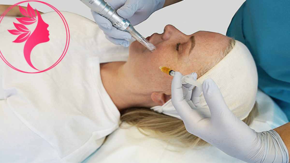 لیست بهترین مراکز مزونیدلینگ در گیشا + هزینه مزونیدلینگ