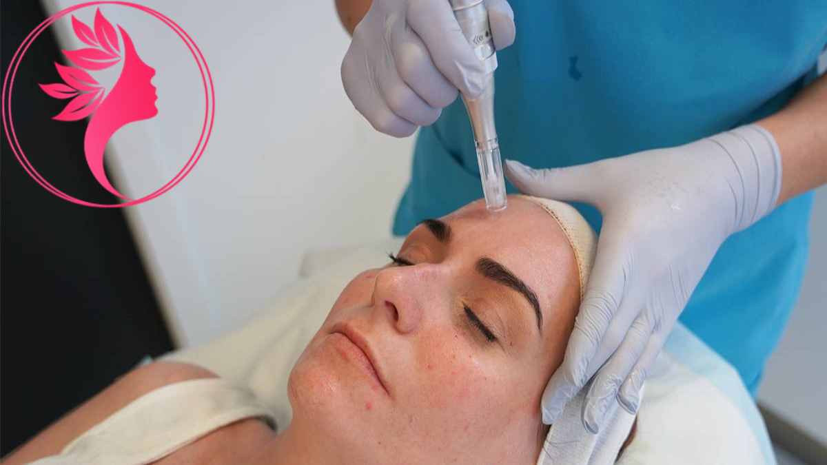 لیست بهترین مراکز میکرونیدلینگ در گیشا + هزینه میکرونیدلینگ