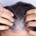لیست بهترین مراکز رفع سفیدی مو در گیشا + هزینه رفع سفیدی مو
