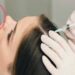 لیست بهترین مراکز مزوتراپی مو در گیشا + هزینه مزوتراپی مو