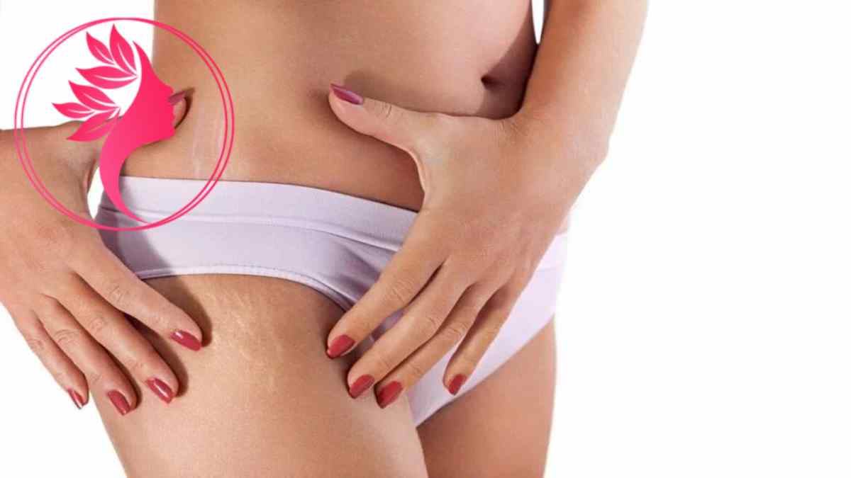 لیست بهترین مراکز درمان ترک پوستی در گیشا + هزینه درمان ترک پوستی