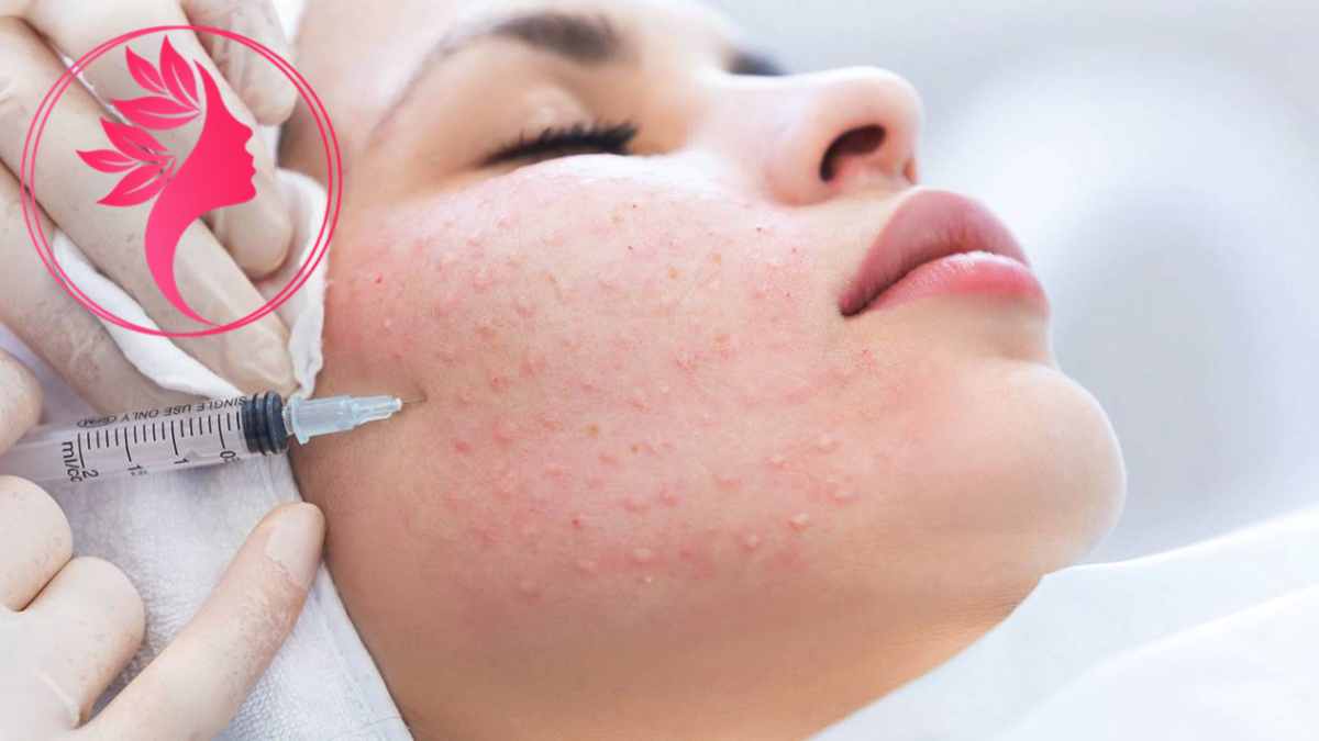 لیست بهترین مراکز مزوتراپی صورت در دربند + هزینه مزوتراپی صورت