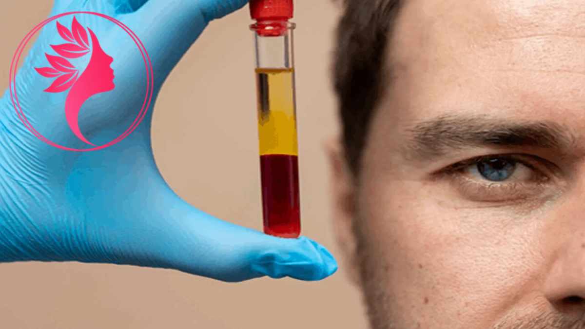 لیست بهترین مراکز پی آر پی در آجودانیه + هزینه پی آر پی
