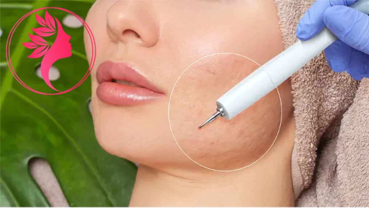 لیست بهترین مراکز سابسیژن در آجودانیه + هزینه سابسیژن