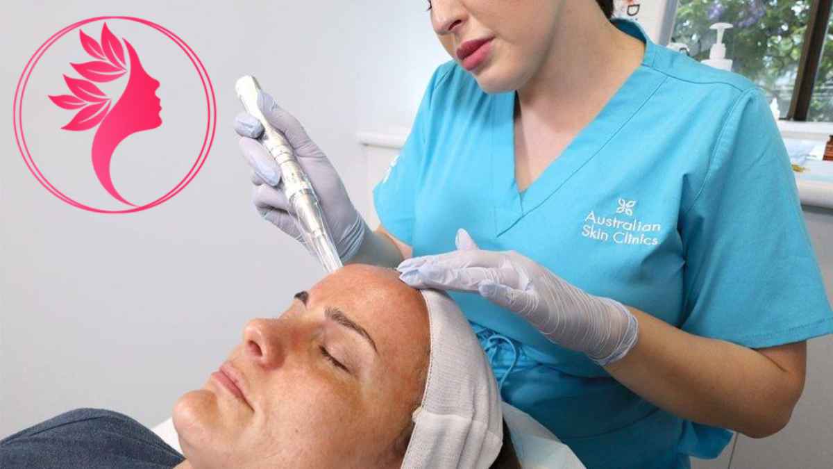 لیست بهترین مراکز مزونیدلینگ در آجودانیه + هزینه مزونیدلینگ