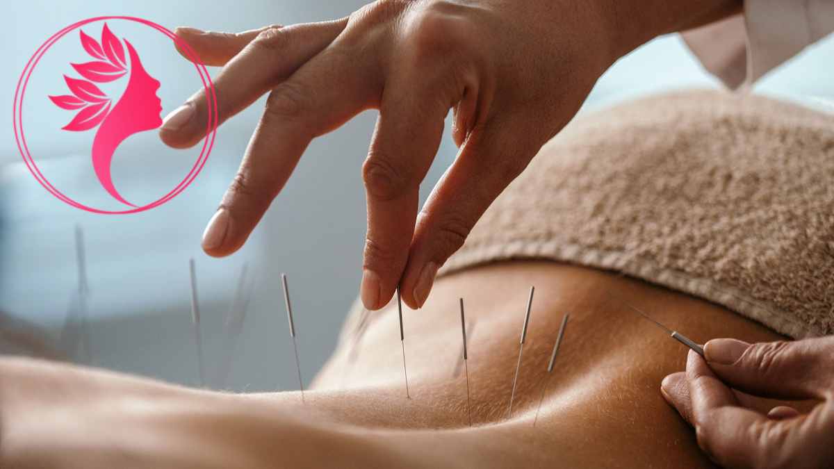لیست بهترین مراکز طب سوزنی در آجودانیه + هزینه طب سوزنی