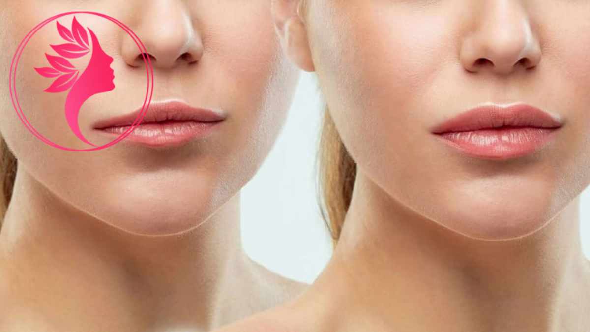 لیست بهترین مراکز لیفت سانترال لب در آجودانیه + هزینه لیفت سانترال لب
