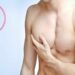 لیست بهترین مراکز ژنیکوماستی در آجودانیه + هزینه ژنیکوماستی