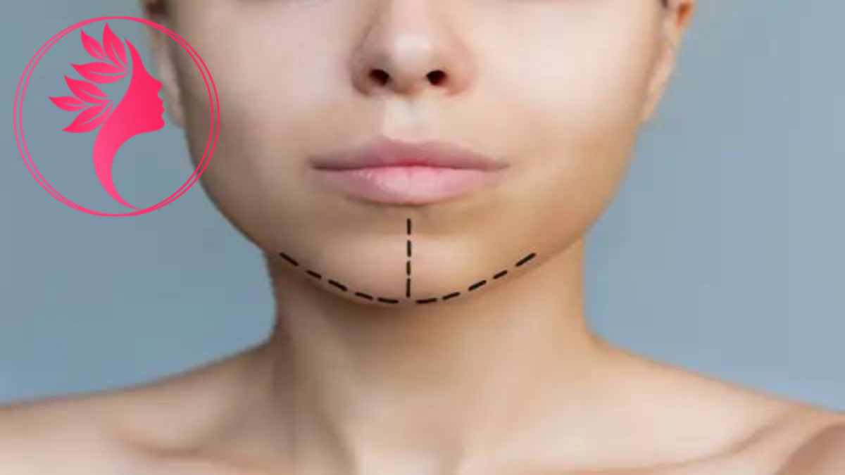 لیست بهترین مراکز جراحی چانه در آجودانیه + هزینه جراحی چانه