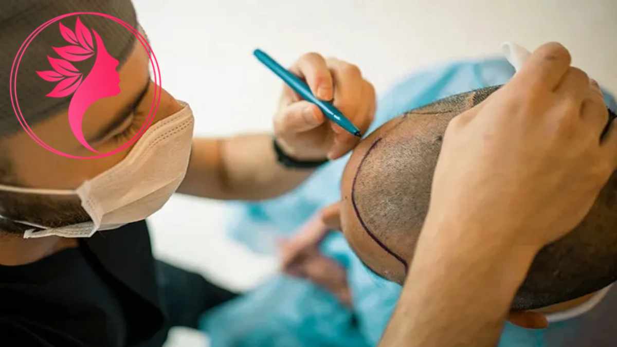 لیست بهترین مراکز کاشت مو در ونک + هزینه کاشت مو