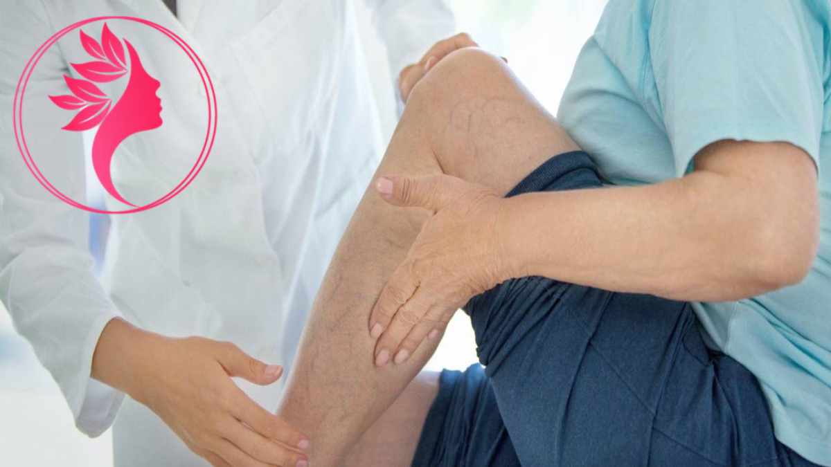 لیست بهترین مراکز درمان واریس در ونک + هزینه درمان واریس